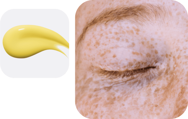 anti-pigmentation-products