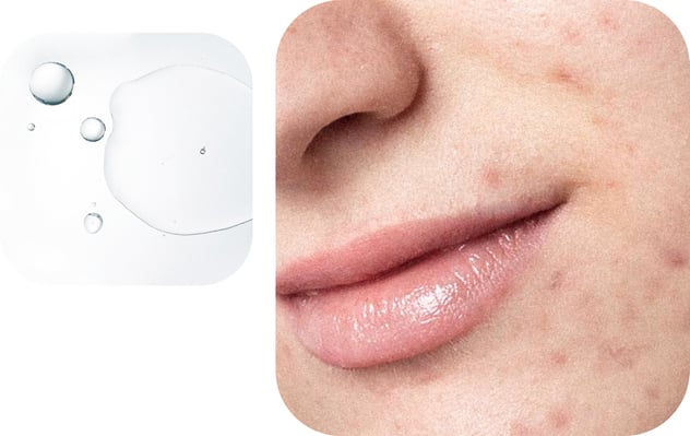 alternating-block.item-5.image.alt