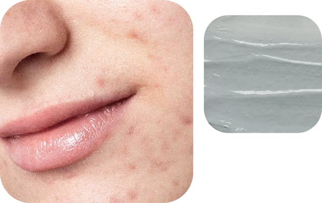 alternating-block-2.item-2.image.alt