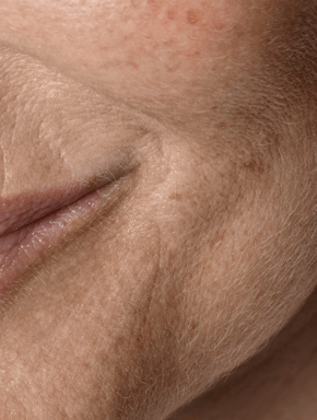 Anti-Aging Hautpflege Set